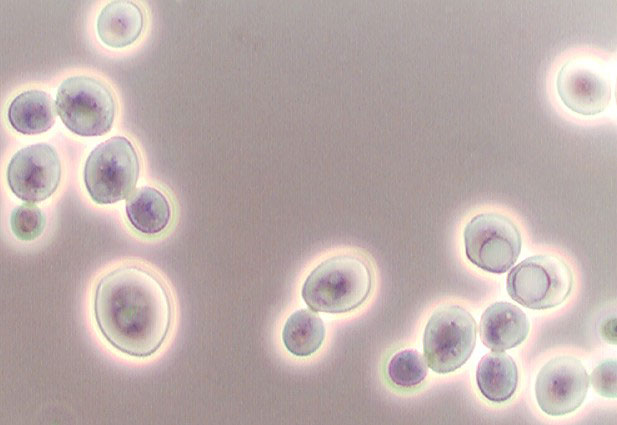Saccharomyces cerevisiae al microscopio - laboratorio Ardoatek